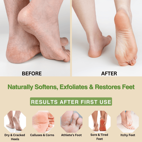 Peppermint, Rosemary & Eucalyptus Massage & Foot Cream | Natural Foot Cream for Dry Feet & Cracked Heels